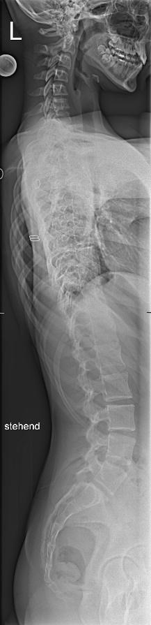 Slide 15