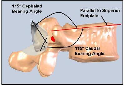 Slide 15