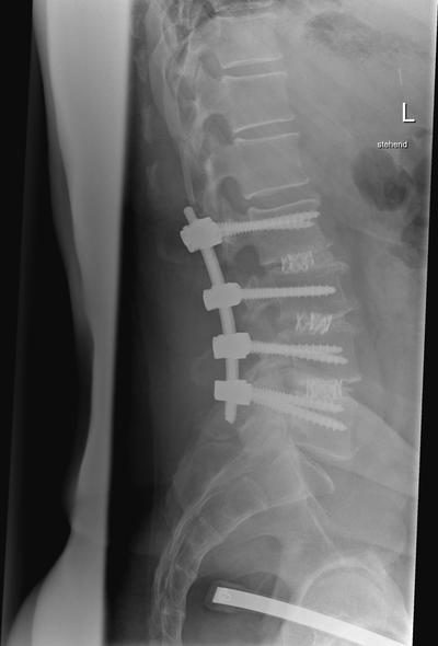 Slide 8